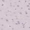 Secreted frizzled-related protein 4 antibody, PA5-62219, Invitrogen Antibodies, Immunohistochemistry frozen image 