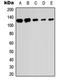 Sentrin-specific protease 6 antibody, GTX56215, GeneTex, Western Blot image 