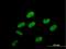 Phosphorylated CTD-interacting factor 1 antibody, H00063935-B01P, Novus Biologicals, Immunofluorescence image 