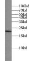 Ubiquitin Conjugating Enzyme E2 V1 antibody, FNab09187, FineTest, Western Blot image 