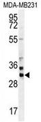 Zinc Finger Protein 816 antibody, AP54689PU-N, Origene, Western Blot image 
