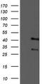 Tropomodulin 1 antibody, TA503170, Origene, Western Blot image 
