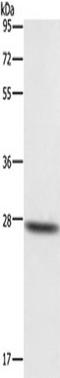 Dickkopf WNT Signaling Pathway Inhibitor 2 antibody, TA349299, Origene, Western Blot image 