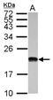 DNA-directed RNA polymerases I and III subunit RPAC2 antibody, NBP2-19884, Novus Biologicals, Western Blot image 