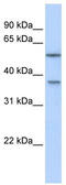 RAB40B, Member RAS Oncogene Family antibody, TA340141, Origene, Western Blot image 
