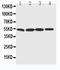 BCL2 Associated Athanogene 5 antibody, LS-C313220, Lifespan Biosciences, Western Blot image 
