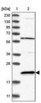 Adenine Phosphoribosyltransferase antibody, PA5-55375, Invitrogen Antibodies, Western Blot image 
