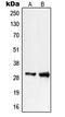 Phosphatidylinositol Glycan Anchor Biosynthesis Class X antibody, LS-C353466, Lifespan Biosciences, Western Blot image 