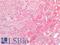 Cathepsin Z antibody, LS-B16348, Lifespan Biosciences, Immunohistochemistry paraffin image 