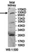 Ubiquitin carboxyl-terminal hydrolase 37 antibody, orb78163, Biorbyt, Western Blot image 