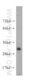 ATPase H+ Transporting V1 Subunit E2 antibody, 13235-1-AP, Proteintech Group, Western Blot image 