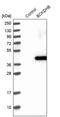Branched Chain Keto Acid Dehydrogenase E1 Subunit Beta antibody, PA5-56785, Invitrogen Antibodies, Western Blot image 