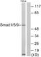 SMAD Family Member 1 antibody, A00728, Boster Biological Technology, Western Blot image 