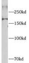 Nuclear Receptor Corepressor 2 antibody, FNab05594, FineTest, Western Blot image 