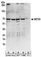 SET Domain Containing 3, Actin Histidine Methyltransferase antibody, NBP2-32136, Novus Biologicals, Western Blot image 