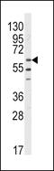 LYN Proto-Oncogene, Src Family Tyrosine Kinase antibody, 63-165, ProSci, Western Blot image 