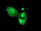 Proteasome 26S Subunit, Non-ATPase 3 antibody, MA5-25873, Invitrogen Antibodies, Immunocytochemistry image 