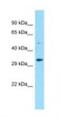 Uncharacterized protein C1orf183 antibody, NBP1-98266, Novus Biologicals, Western Blot image 