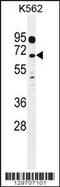 Leucine Rich Repeat Containing 63 antibody, 56-101, ProSci, Western Blot image 
