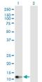 Guanylate Cyclase Activator 2B antibody, H00002981-D01P, Novus Biologicals, Western Blot image 