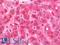Copper Metabolism Domain Containing 1 antibody, LS-B11735, Lifespan Biosciences, Immunohistochemistry paraffin image 