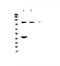 Androgen Receptor antibody, PA1496, Boster Biological Technology, Western Blot image 