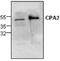 Carboxypeptidase A2 antibody, GTX59701, GeneTex, Western Blot image 