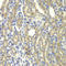 Kelch Repeat And BTB Domain Containing 7 antibody, LS-C349109, Lifespan Biosciences, Immunohistochemistry paraffin image 