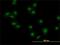 Makorin Ring Finger Protein 2 antibody, H00023609-M01, Novus Biologicals, Immunocytochemistry image 