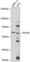 Parathyroid Hormone 2 Receptor antibody, 19-260, ProSci, Western Blot image 