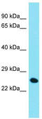 Charged multivesicular body protein 4c antibody, TA331315, Origene, Western Blot image 
