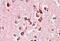 Unc-5 Netrin Receptor C antibody, NBP1-37002, Novus Biologicals, Immunohistochemistry paraffin image 