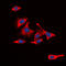 Interleukin 13 Receptor Subunit Alpha 1 antibody, LS-C359026, Lifespan Biosciences, Immunofluorescence image 
