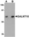 Polypeptide N-Acetylgalactosaminyltransferase 10 antibody, MBS150336, MyBioSource, Western Blot image 