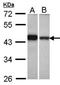 GIPC PDZ Domain Containing Family Member 1 antibody, orb73599, Biorbyt, Western Blot image 