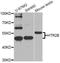 5-Hydroxytryptamine Receptor 2B antibody, LS-C746820, Lifespan Biosciences, Western Blot image 
