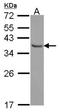 E2F Transcription Factor 6 antibody, NBP2-14936, Novus Biologicals, Western Blot image 