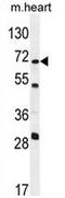 5'-Nucleotidase, Cytosolic IB antibody, AP52947PU-N, Origene, Western Blot image 