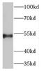 Proprotein Convertase Subtilisin/Kexin Type 4 antibody, FNab06225, FineTest, Western Blot image 
