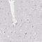 Echinoderm microtubule-associated protein-like 4 antibody, HPA065337, Atlas Antibodies, Immunohistochemistry frozen image 