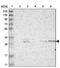 Dimethylarginine Dimethylaminohydrolase 2 antibody, PA5-52942, Invitrogen Antibodies, Western Blot image 