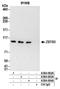 Zinc Finger And BTB Domain Containing 5 antibody, A304-062A, Bethyl Labs, Immunoprecipitation image 