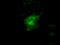 cAMP-dependent protein kinase type I-alpha regulatory subunit antibody, LS-C114736, Lifespan Biosciences, Immunofluorescence image 