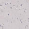 Fc Fragment Of IgG Receptor And Transporter antibody, AMAb91200, Atlas Antibodies, Immunohistochemistry paraffin image 