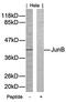 JunB Proto-Oncogene, AP-1 Transcription Factor Subunit antibody, orb14442, Biorbyt, Western Blot image 