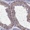 MAGE Family Member B1 antibody, HPA001193, Atlas Antibodies, Immunohistochemistry paraffin image 