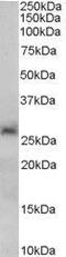 Sirtuin 3 antibody, GTX89507, GeneTex, Western Blot image 