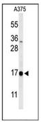 DAZ Associated Protein 2 antibody, AP51189PU-N, Origene, Western Blot image 