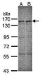 ERCC Excision Repair 6, Chromatin Remodeling Factor antibody, orb69724, Biorbyt, Western Blot image 