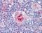 Intercellular Adhesion Molecule 1 antibody, orb87698, Biorbyt, Immunohistochemistry paraffin image 